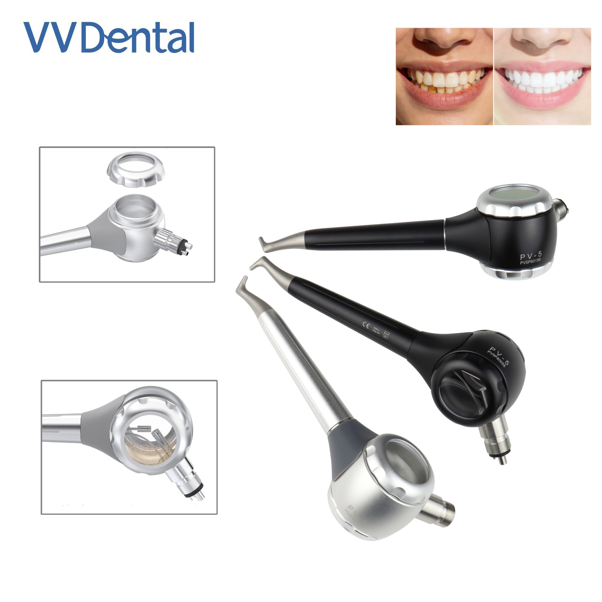 Teeth Whitening Free - Pistola per Sabbiatura Dentale VV a