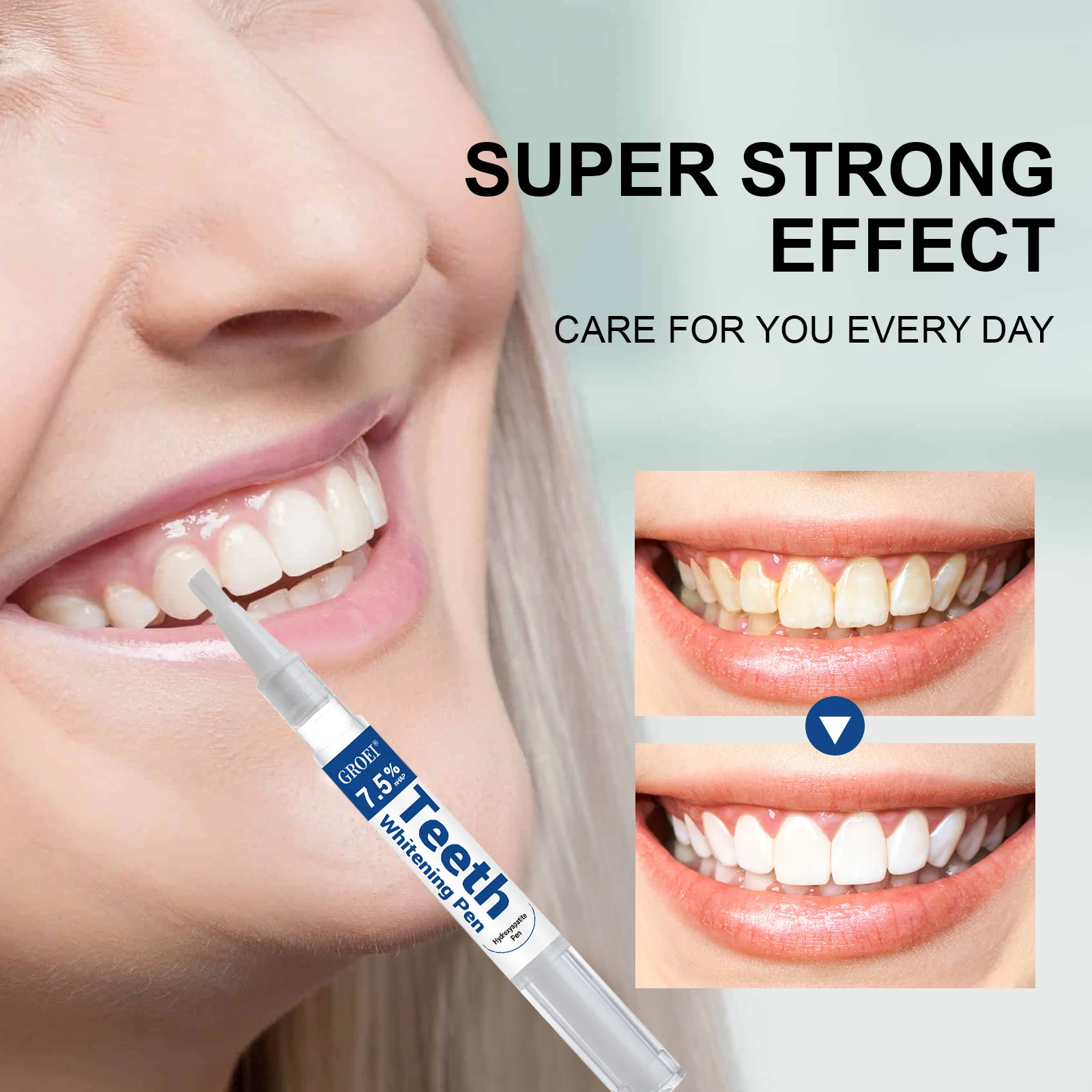 Penna per sbiancamento dei den - Teeth Whitening Levels recensione e prezzo