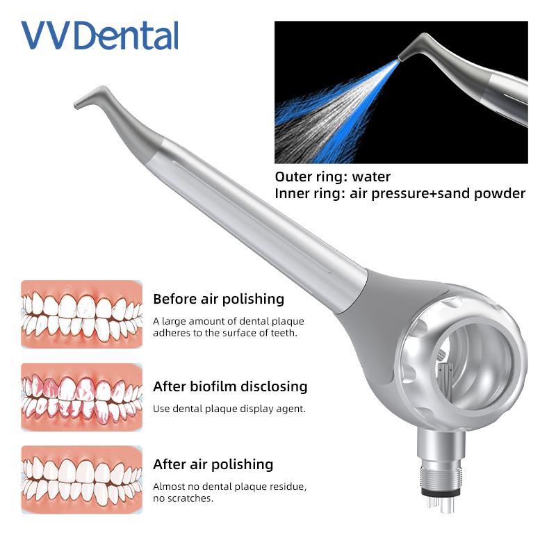 Pistola per Sabbiatura Dentale - Teeth Whitening Free recensione e prezzo