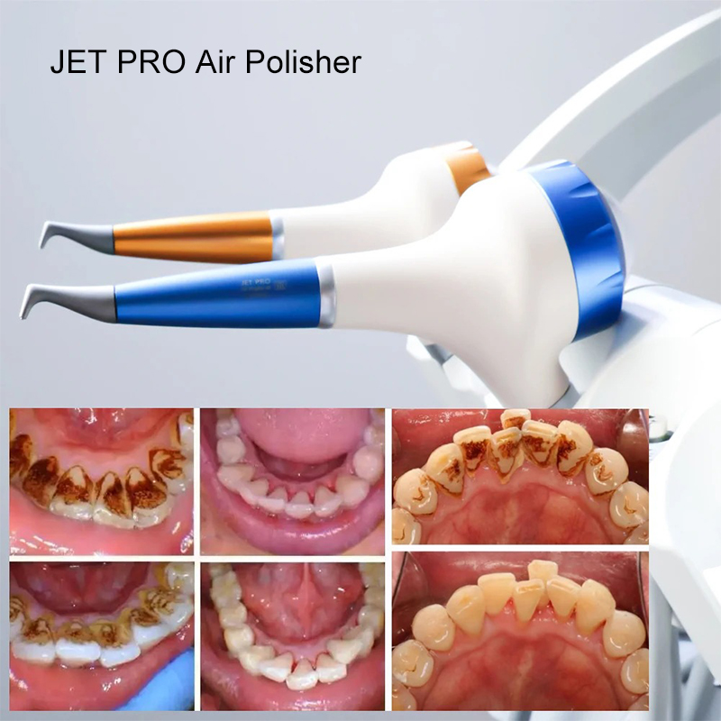 VV Dental Air Polishing Prophy - Teeth Whitening Free recensione e prezzo