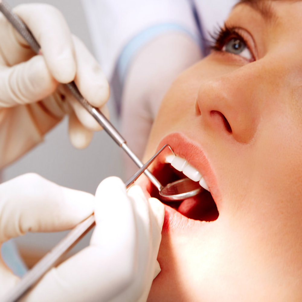 5 pz In Acciaio Inox Dentale B - Teeth Whitening Products recensione e prezzo
