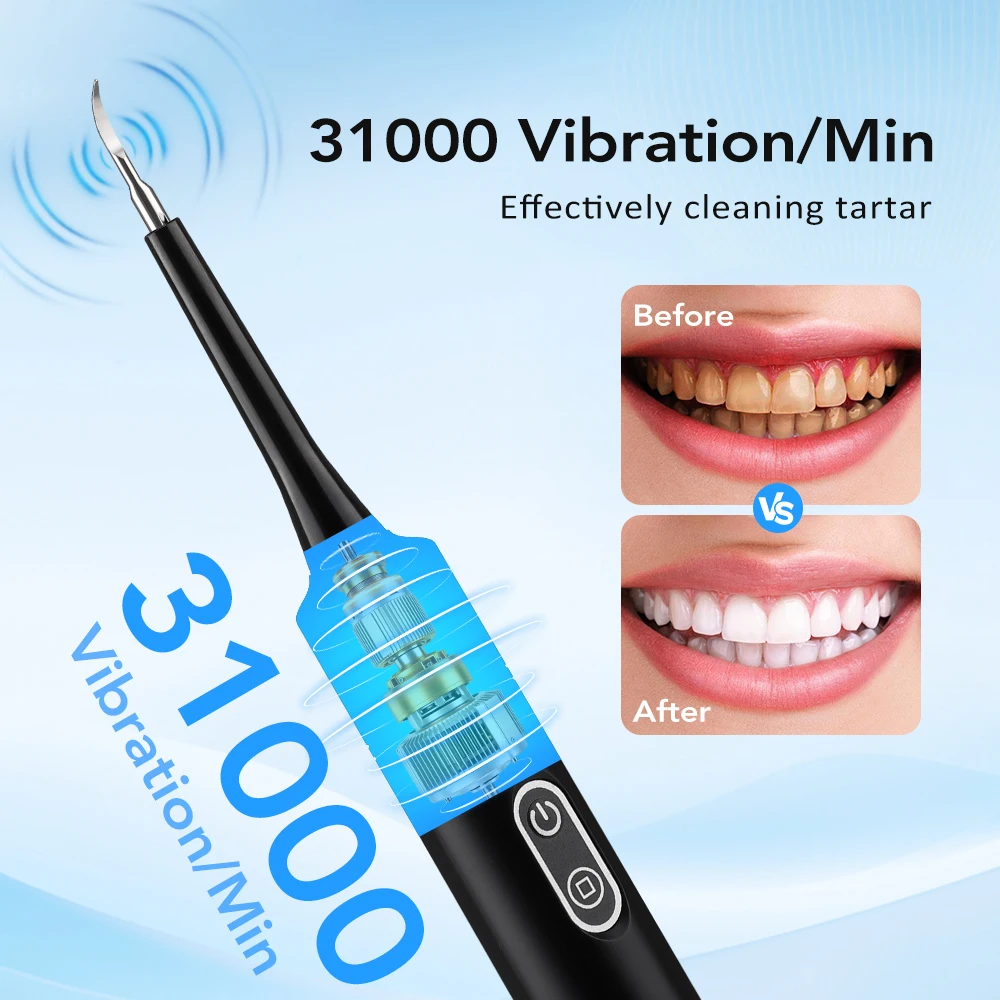 Scalatore Dentale Elettrico a  - Teeth Whitening Products recensione e prezzo